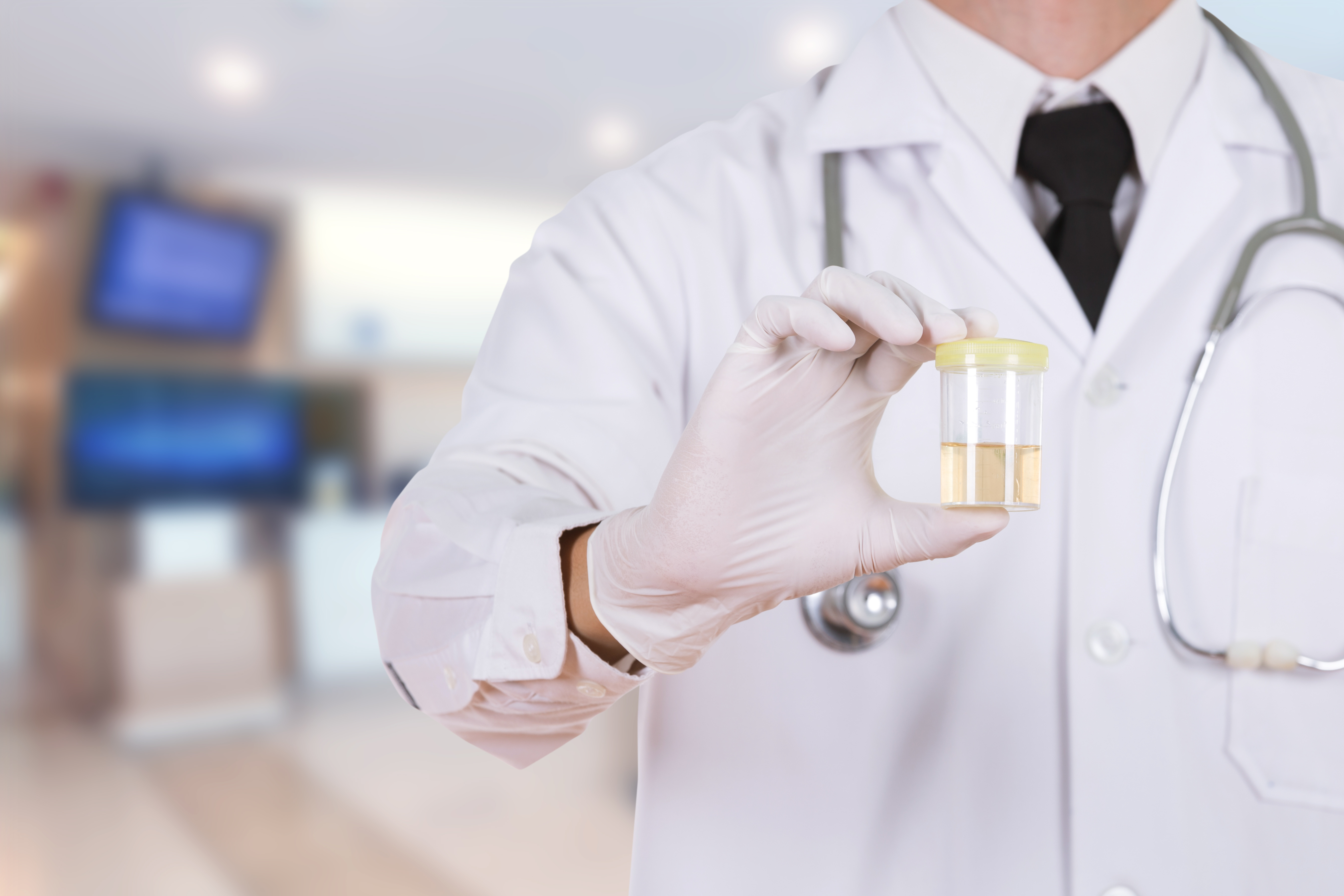 urine drug test, drug testing for employers, employee screening, drug screening for employers