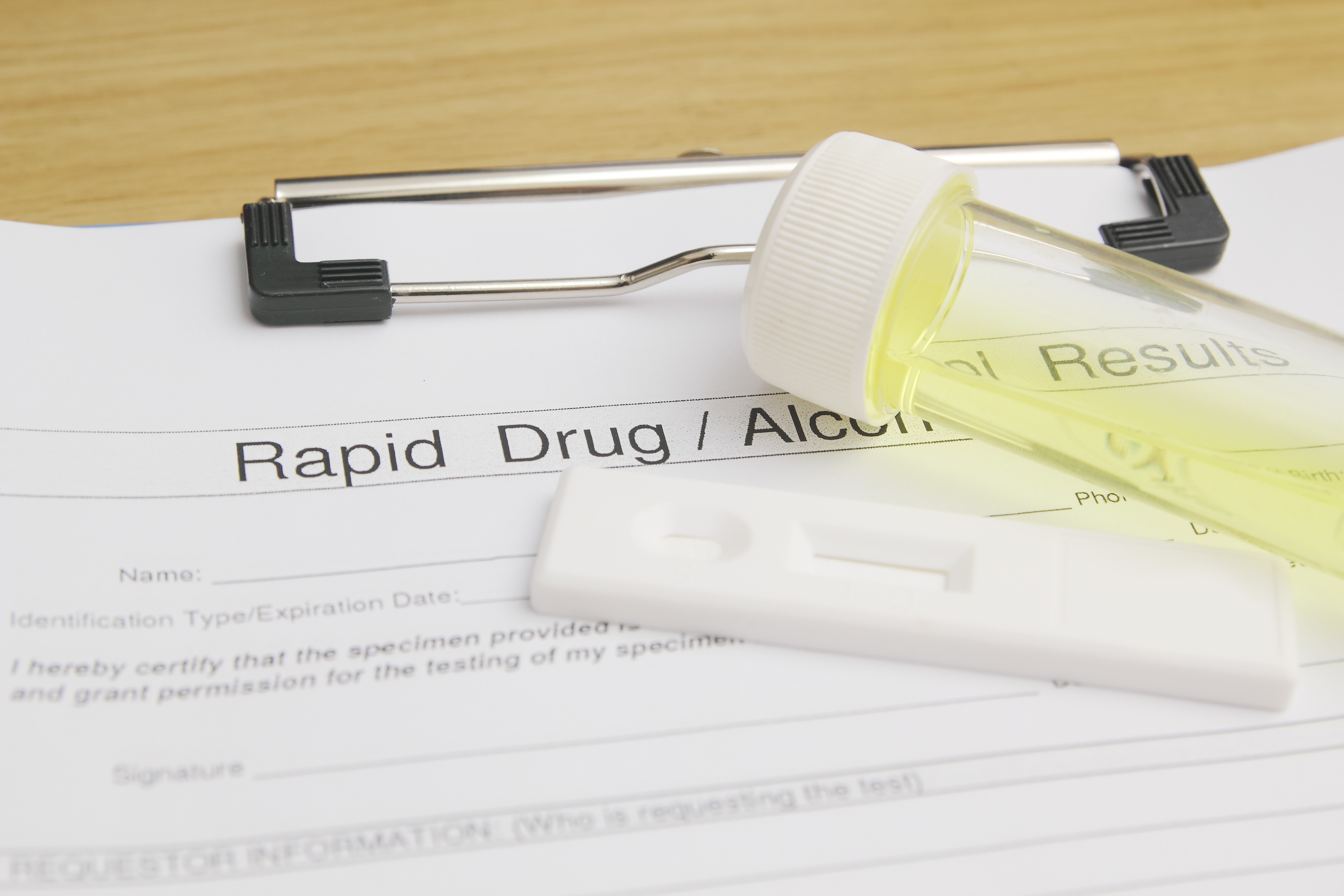 What Do Pre-Employment Drug Tests Look For?
